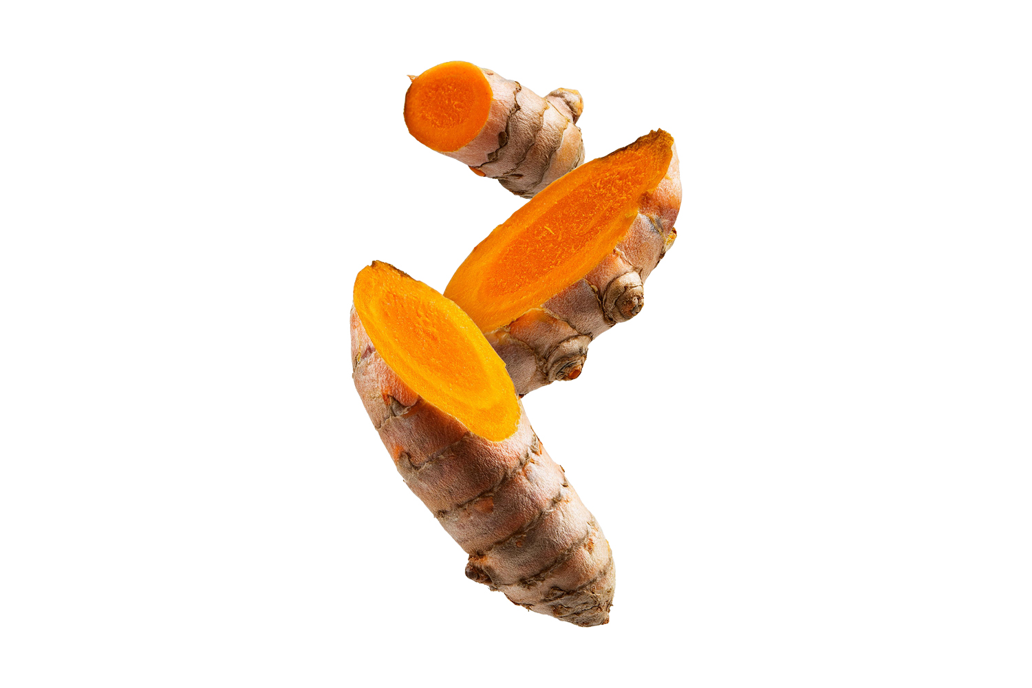 Zerdeçal